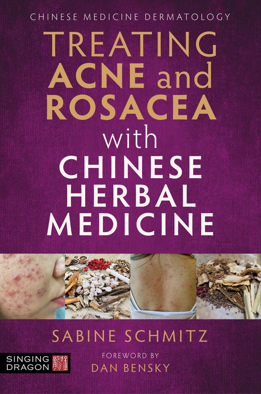 Treating Acne and Rosacea with Chinese Herbal Medicine by Dan Bensky, Sabine Schmitz